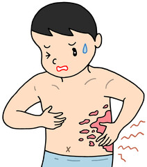 Fototapeta premium 病気・疾患のイラスト - 帯状疱疹・皮膚疾患・皮膚炎