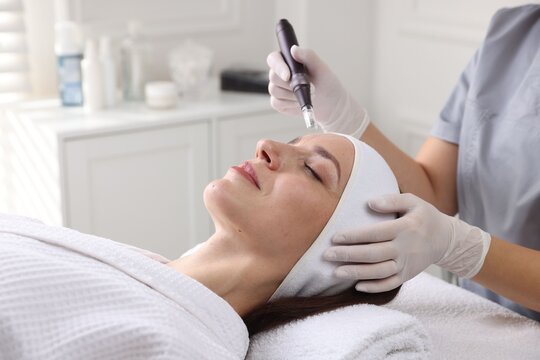 Woman undergoing microneedling procedure in beauty salon, closeup