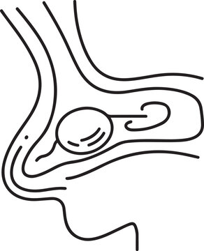 Sinus cyst drawn with lines. Benign sac-like formation in the cavity of the paranasal sinus. Medical vector illustration for different uses. one line Icon drawing