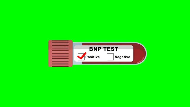 BNP Test Positive Result in Test Tube Animation on green screen background