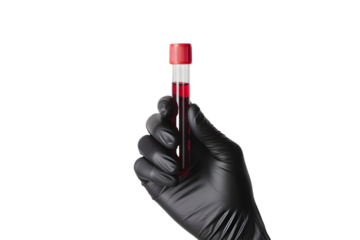 Hand wearing a black glove holding a blood sample in a test tube with a red cap isolated on transparent background