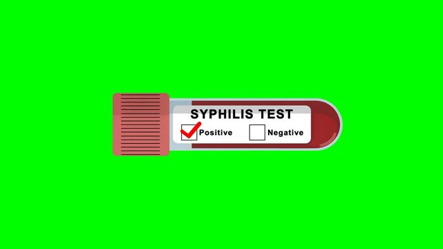 Syphilis Test Positive Result on test tube