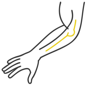 Ulnar