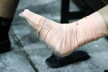 Close-up of a foot wrapped in a medical bandage, showing injury or sprain, with visible wear and texture, symbolizing healthcare, pain, recovery, and first aid treatment.