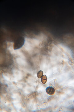Microscopic Visualization of Darkly Pigmented Fungal Conidia and Hyphal Structures in a Clear Wet Mount