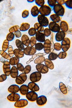 Microscopic Visualization of Darkly Pigmented Fungal Conidia and Hyphal Structures in a Clear Wet Mount