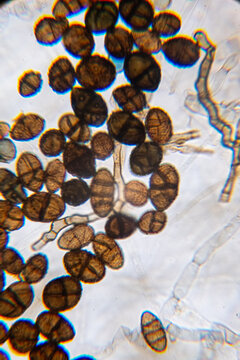 Dematiaceous Fungal Spores Exhibiting Transverse and Longitudinal Septation, Likely of the Genus Alterna