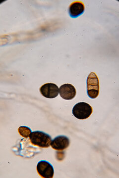 Dematiaceous Fungal Spores Exhibiting Transverse and Longitudinal Septation, Likely of the Genus Alterna