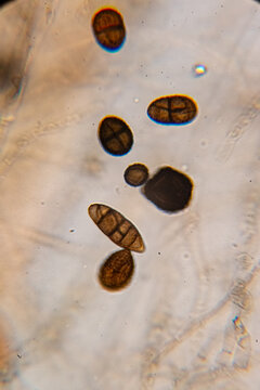 Dematiaceous Fungal Spores Exhibiting Transverse and Longitudinal Septation, Likely of the Genus Alterna