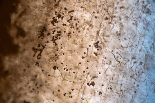 High-Power Photomicrograph Revealing Multicellular Dematiaceous Fungal Spores Exhibiting Transverse and Longitudinal Septa