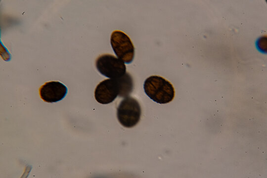 Dematiaceous Fungal Spores Exhibiting Transverse and Longitudinal Septation, Likely of the Genus Alterna