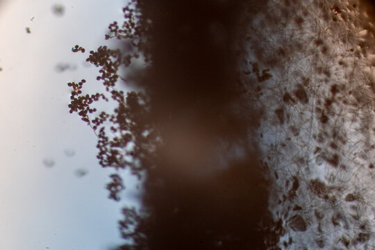 High-Power Photomicrograph Revealing Multicellular Dematiaceous Fungal Spores Exhibiting Transverse and Longitudinal Septa