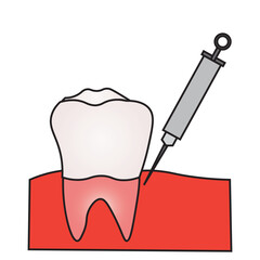 Dental Anesthesia Injection