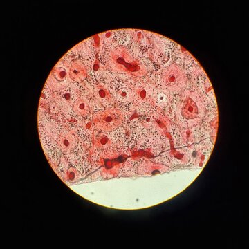 Microscopic image of bone tissue showing embedded bone cells (osteocytes) in lacunae, used in anatomy and histology studies.