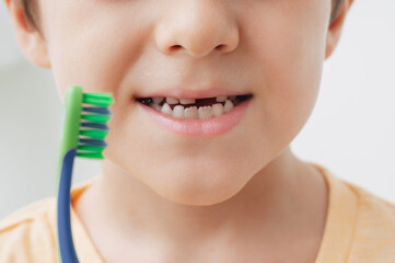 The smile of a little boy without a baby tooth with a toothbrush, close-up. Oral care in children.