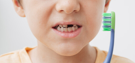 The smile of a little boy without a baby tooth with a toothbrush, close-up. Panoramic banner. Oral care in children.