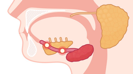 唾石症のイラスト