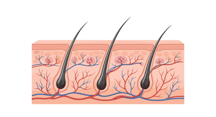 A detailed medical diagram illustrating a cross-section of the human skin, showing hair follicles, roots, and blood vessels.