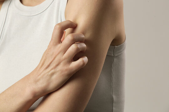 Close up view of woman scratching her arm. Health care and medical concept.	