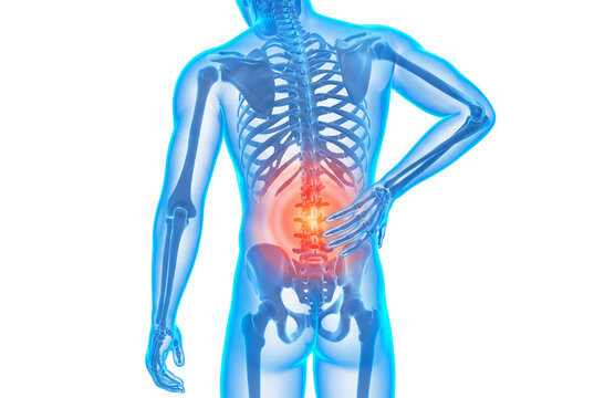 Medical illustration of lower back pain with highlighted spine on white or transparent background.