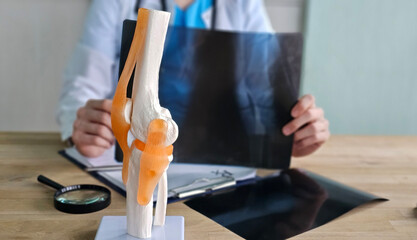 Doctor examines knee model while reviewing X-ray of patient