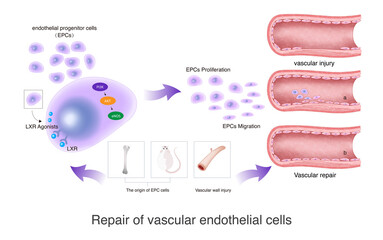 When the vascular endothelium is damaged, primitive progenitor cells can be imported into the body to reach the damaged vascular site and repair the vascular endothelium.
