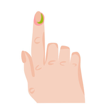Finger Nail Infection