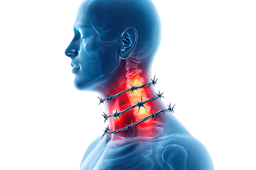 Detailed anatomical illustration of human neck showing severe cervical pain with barbed wire pressure effect around inflamed vertebrae isolated on white background
