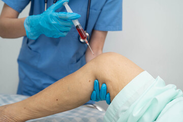 Asian doctor inject Hyaluronic acid platelet rich plasma into knee of senior woman.