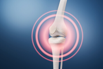 Knee joint bone pain with osteoarthritis tendonitis and gout arthritis inflammation concept 3D rendering