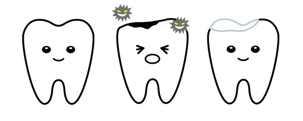 健康な歯と虫歯と白い詰め物で治療した歯のセット
