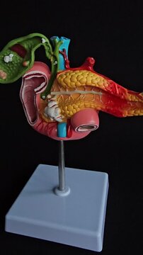 Pancreatitis, pancreatic cancer, gallbladder and bile duct, human anatomy model