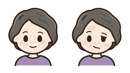 健常と左顔面神経麻痺の高齢女性のイラスト