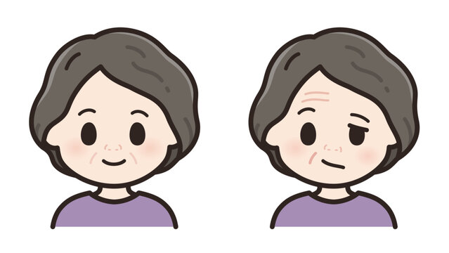 健常と左顔面神経麻痺の高齢女性のイラスト