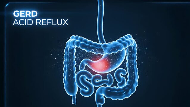 Human digestive system showing GERD acid reflux in the stomach
