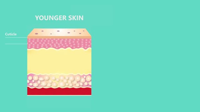 The diagram of younger skin and aging skin showing the decrease in collagen and broken elastin in older skin - 2D animation