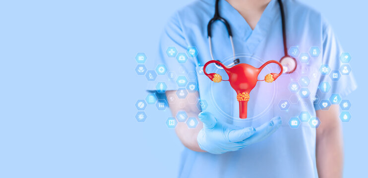 Gynecologist examining a uterine model. Concept of cervical cancer screening and Pap test awareness. HPV. 3D model of a cervix with cancerous cells. Isolated.