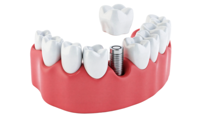 Realistic 3D Dentistry Concept Illustration