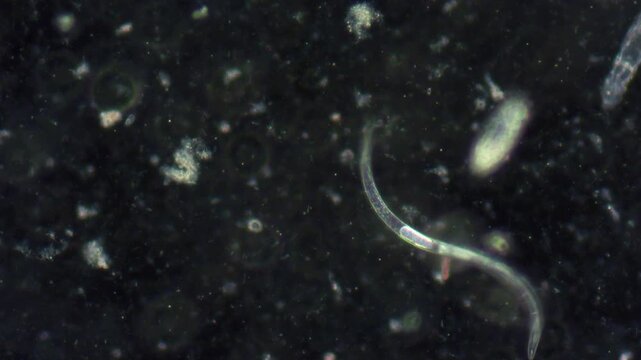 A nematode moves through an aquatic environment by bending its body. Nematode movement under a microscope.
