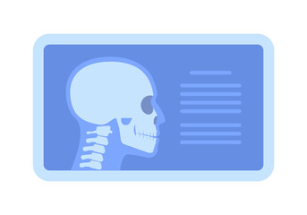 Computer screen with x-ray picture of human head, side view. 