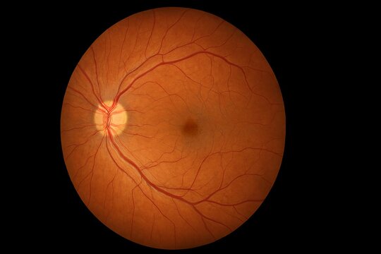 Fundus photograph of the human retina showing optic disc, macula, and blood vessels