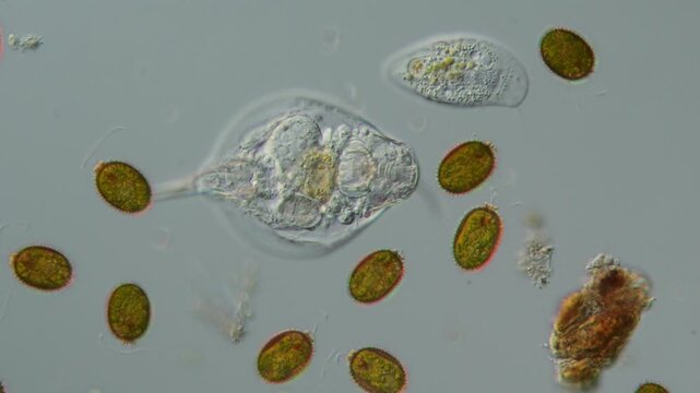 Ein R&auml;dertier mit Algen und Pantoffeltier als Plankton im S&uuml;&szlig;wasser, normal und Zeitlupe