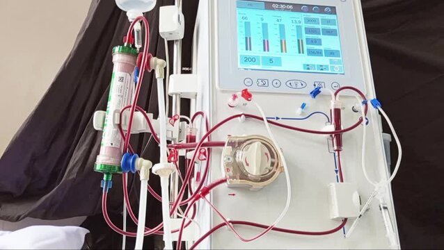 Hemodialysis machines, used to filter and clean the blood of waste and excess fluid when the kidneys are not functioning, replace the function of damaged kidneys by cleaning the blood outside the body
