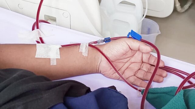 Vascular access is very important for dialysis patients to facilitate the flow of blood out to be filtered by the dialysis machine which functions as an artificial kidney and returned back to the body