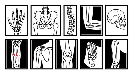 Human Skeletal System Diagram &ndash; Labeled Illustrations of Skull, Spine, Joints, Limbs, and Fracture for Medical, Educational, and Orthopedic Reference