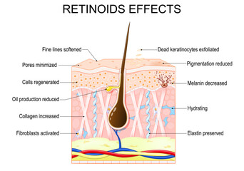 Retinoids effects for skin.
