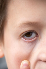 Obraz premium Close-up child brown eye, finger pulling lower eyelid, playful gesture, curiosity, childhood expression, macro portrait, human face detail, boy making funny face close-up