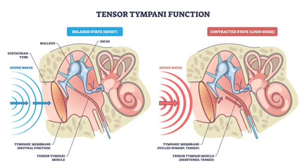 Tensor tympani function, contrasts relaxed vs contracted states, showing tympanic membrane, malleus-incus chain, and sound waves that dampen loud input to protect hearing, transparent background.
