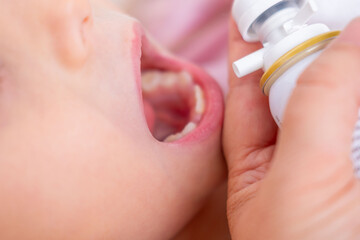 Closeup child's open mouth receiving aerosol spray from hand-held bottle, suggesting treatment for sore throat, tonsillitis, asthma, or allergy quick relief, young patient receiving medicated spray