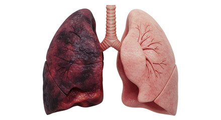 3D Render of Human Lungs with Airway and Bronchi